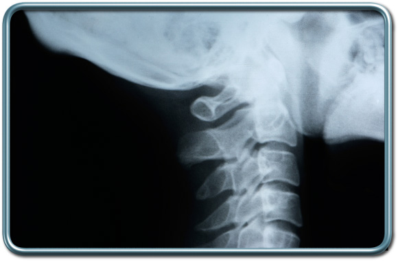 עמוד השדרה הצווארי- Cervical spine